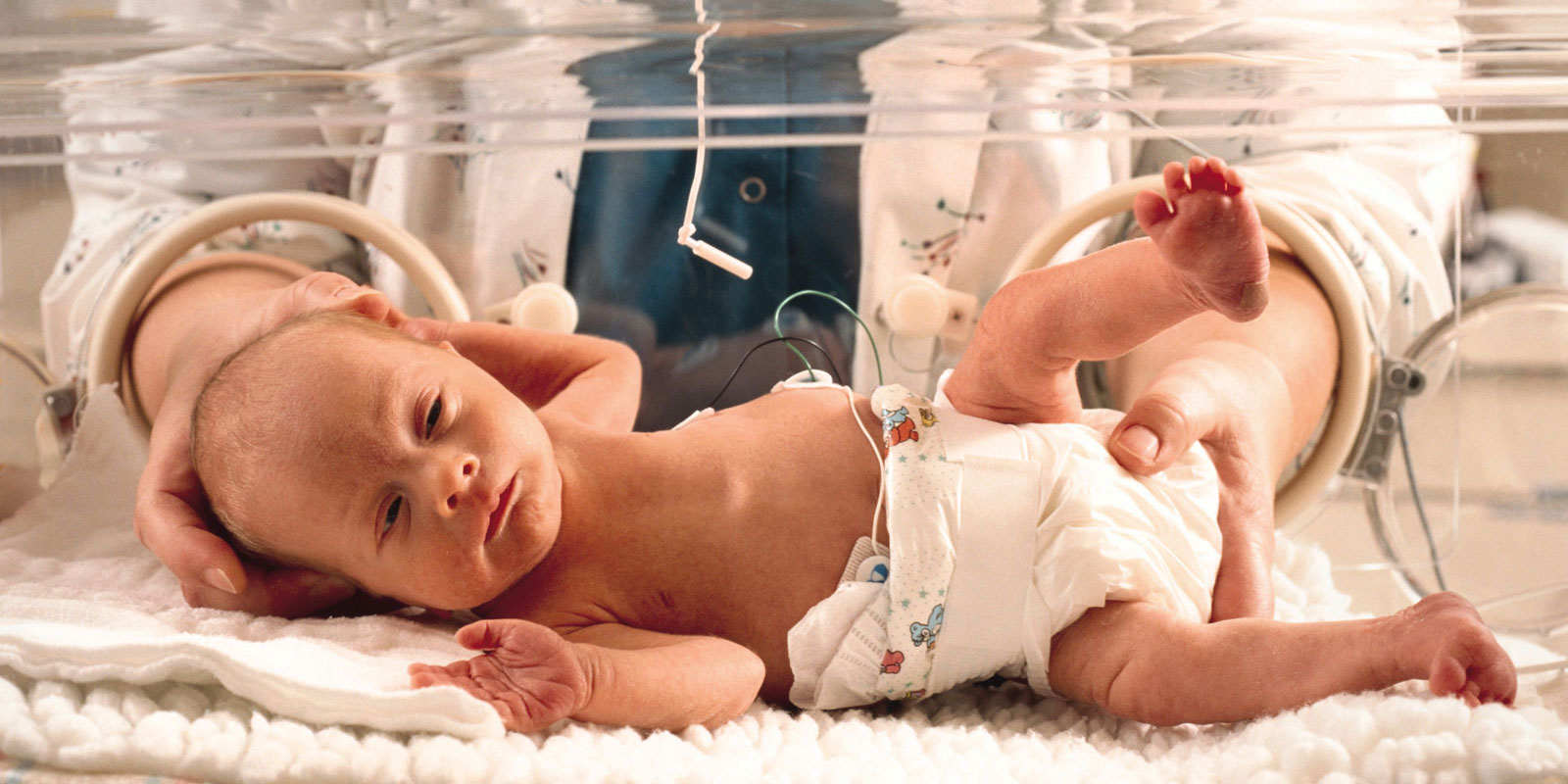 NICU baby